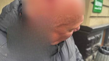 У Львові чоловіку на голову впала частина ліпнини з фасаду будинку