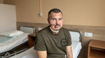 На війні розірвало обличчя: львівські лікарі провели складну реконструкцію бійцю