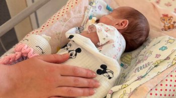 Львівські медики виходили недоношену дівчинку вагою 900 грамів