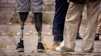 Людина з протезами