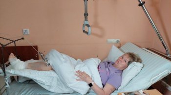 «Ракета Путіна прилетіла мені у квартиру»: травмована внаслідок обстрілу львів'янка готується до операції