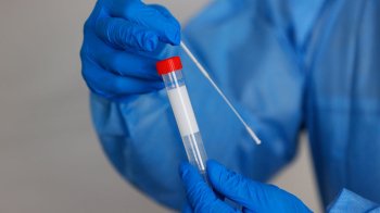 Коронавірус: 28 липня, актуальна статистика