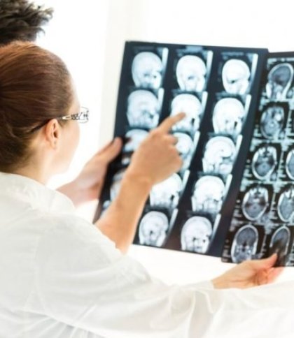 Шматок ліпнини впав на голову: у Львові 17-річну дівчину доправили в лікарню із підозрою на струс мозку