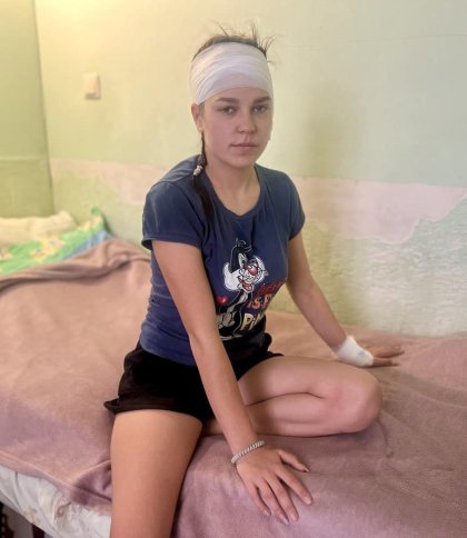 Гігантська пухлина у вусі: у Львові прооперували 17-річну дівчинку