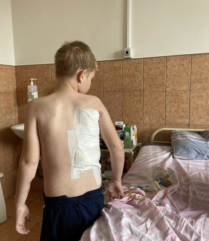 Пережив кому і вісім операцій: львівські лікарі врятували 11-річного хлопця з Харкова