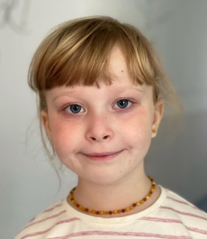 Львівські медики видалили 5-річній дівчинці з легенів величезний гнійник