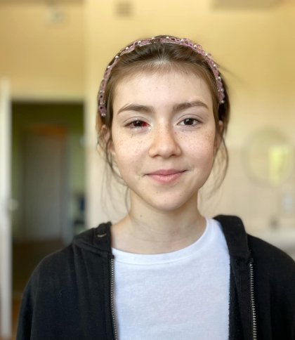 Львівські офтальмологи врятували око 11-річної дівчинки
