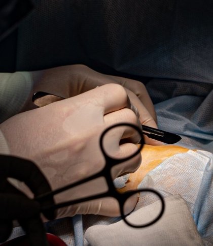 З початку війни львівські медики провели вісім трансплантацій органів