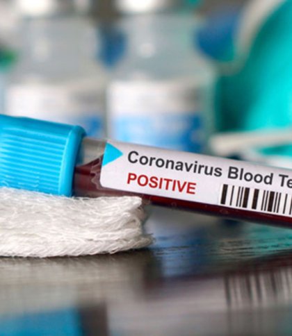 Коронавірус: 1 липня, актуальна статистика