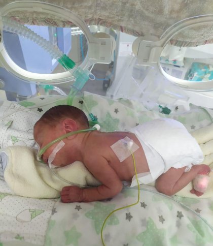 Львівські лікарі виходили хлопчика, народженого з вагою 960 грамів