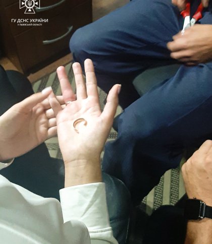 У Львові рятувальники вивільнили палець жінки: він застряг в обручці