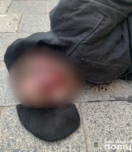 Поліція розповіла деталі нападів на жінок в центрі Львова