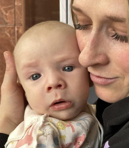 У Львові лікарі врятували малюка зі зрощенням носових отворів