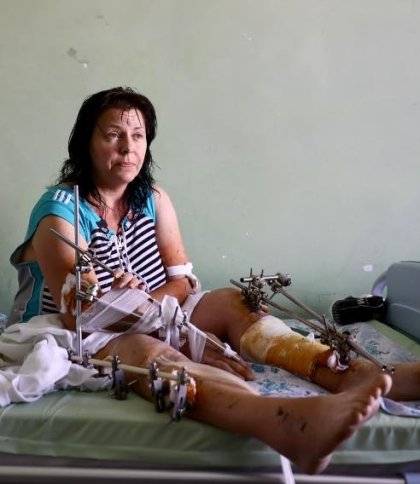 Львівські лікарі рятують ногу жінці, яка опинилася під завалами після вибуху ракети