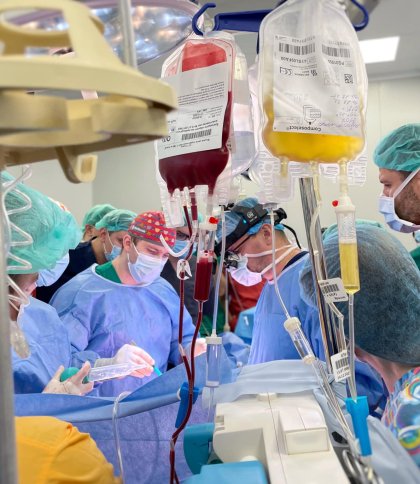 У Львові виконали першу в Україні спліт-трансплантацію печінки
