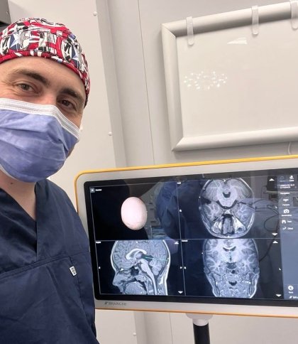 Львівські лікарі отримали обладнання для оперування головного та спинного мозку