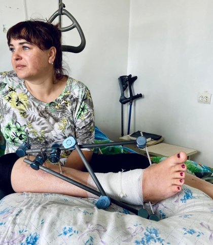 Відірвало шматок кістки на нозі: у Львові врятували жінку з Авдіївки, яку вразило уламком ракети