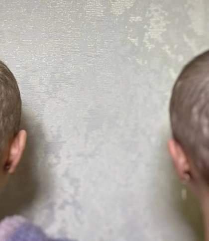 Випало волосся та «злізла» шкіра: львівські медики лікують 13-річних двійнят з надлишком вітаміну А в організмі