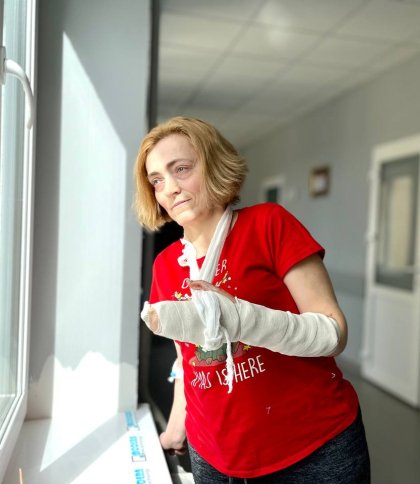 Львівські лікарі розділили жінці нерухомі пальці руки, які за 30 років зрослися