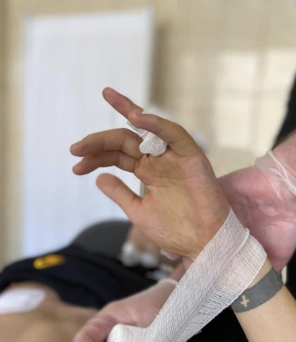 Щоб врятувати палець використали частину ребра: у Львові лікували 24-річного чоловіка із пухлиною кістки