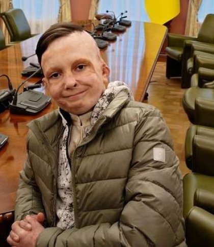 11-річний львів’янин, який вижив після важких опіків внаслідок атаки РФ, отримав нагороду