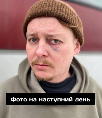 Актор Микола Лемешко