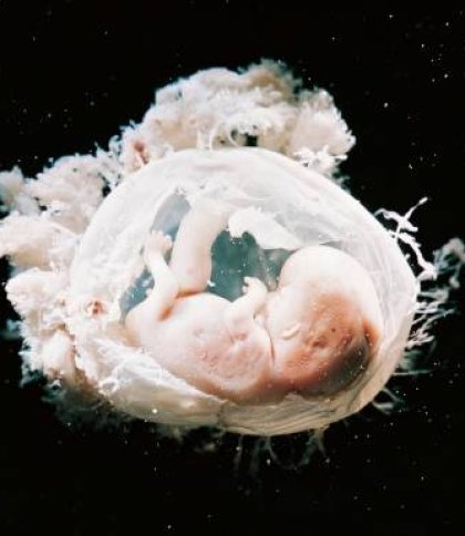 В Індії дівчинка народилася із вісьмома ембріонами всередині