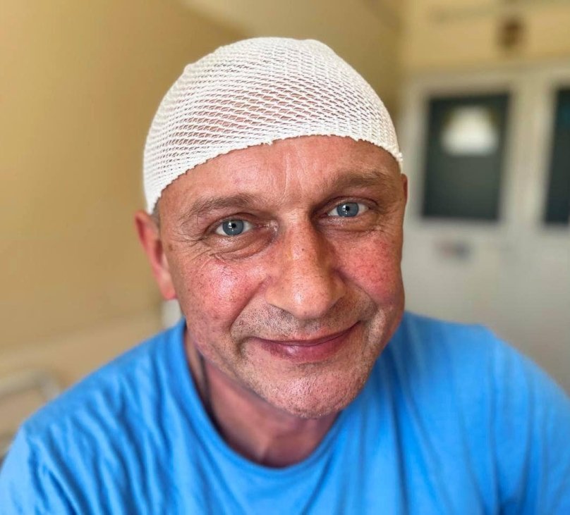 Пацієнт Олег після видалення величезної пухлини. Фото: Перше медичне об'єднання Львова