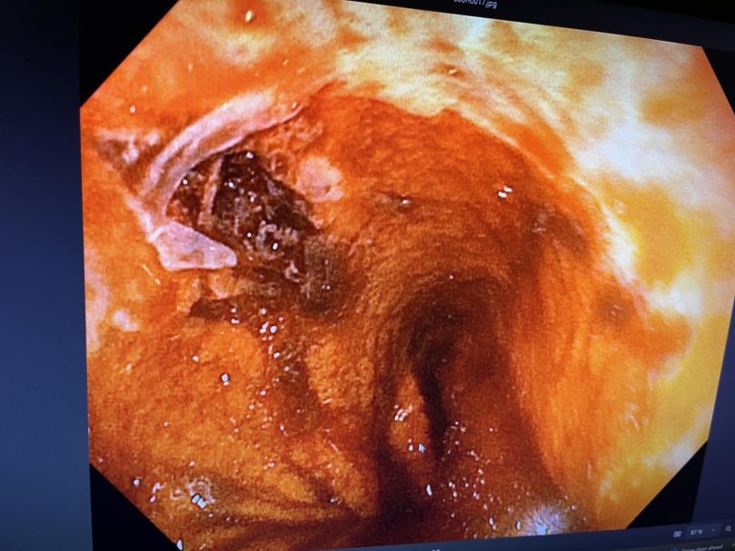 У Дрогобичі врятували 29-річного пацієнта з масивною кровотечею – 01