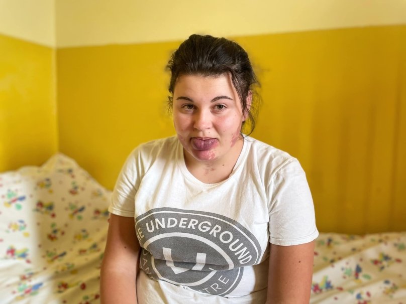 17-річна Наталя із Вінниці. Фото: ПМО Львова