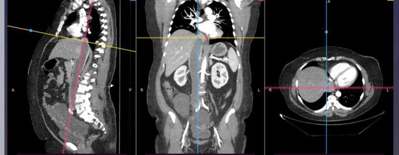 На фото результати обстежень жінки