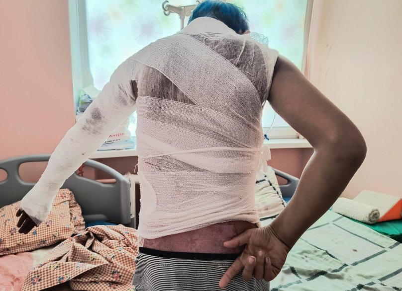 У Львові рятують 14-річного одесита, якого вдарило струмом під час селфі на електричці – 01