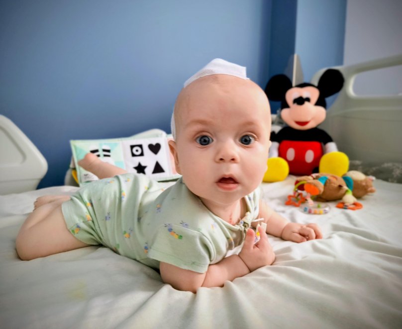 Дитина після операції