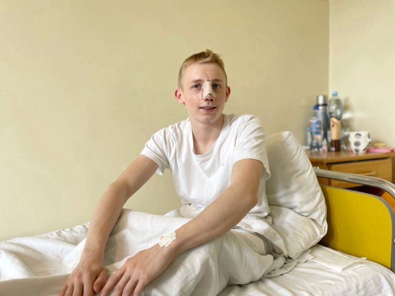 15-річний Богдан народився з косметичним дефектом.