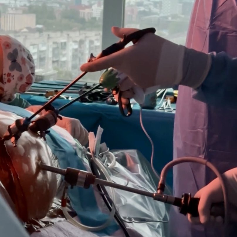 У Львові брат віддав нирку старшій сестрі з цукровим діабетом – 03