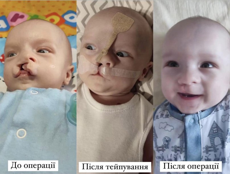 Фото: Львівська обласна дитяча клінічна лікарня «Охматдит»