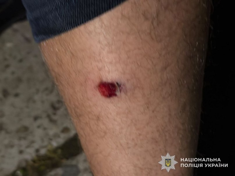 Фото: Національна поліція 