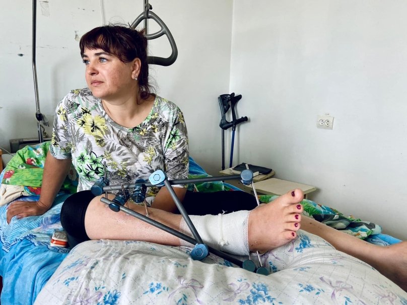 34-річна Оксана з травмою ноги. Фото: ПМО Львова