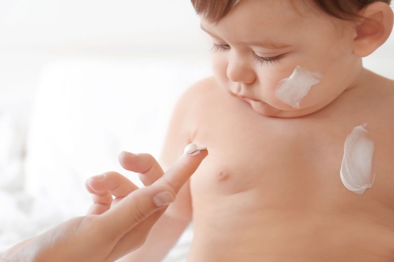 Турбота про шкіру малюка: як упоратися з атопічним дерматитом та алергією – 03