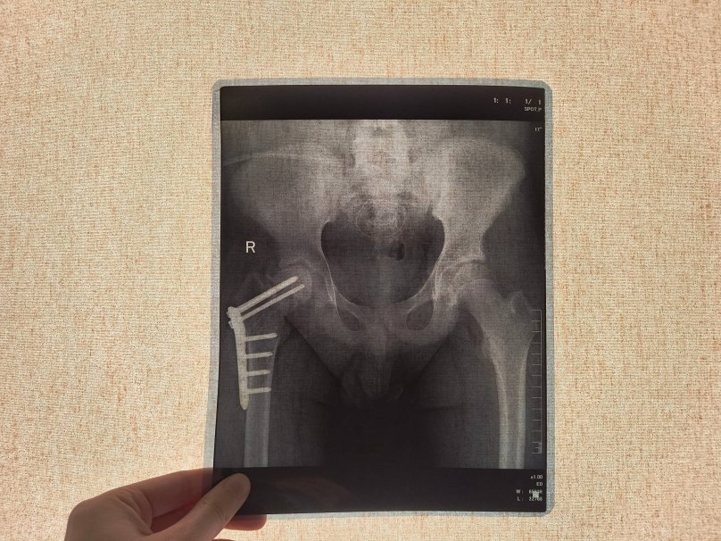 Ретгенний знімок