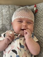 Львівські медики успішно видалили небезпечну пухлину мозку у двомісячної дівчинки – 02