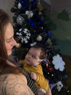 Львівські медики успішно видалили небезпечну пухлину мозку у двомісячної дівчинки – 03