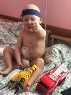 Медики зі Львова успішно видалили 2-річному хлопчику з Краматорська нирку з пухлиною – 01