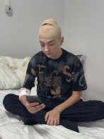 У Львові лікарі видалили 17-річному підлітку рідкісну пухлину в мозку – 02