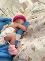 Львівські медики виходили немовля вагою 600 грамів – 02