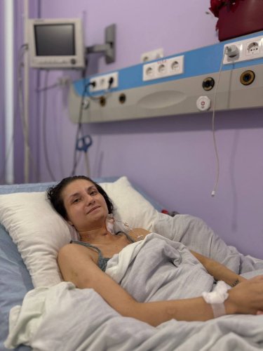 В Університетській лікарні Львова врятували жінку, у якої через пневмонію на 80% відмовили легені – 01