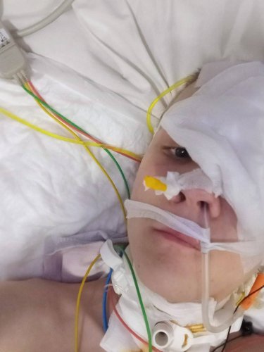 Львівські медики врятували 16-річного хлопця, який впав у кому через гній у мозку – 02