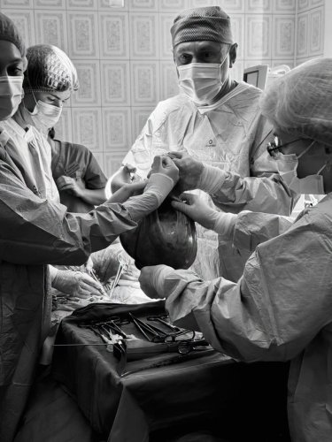 Львівські лікарі видалили жінці кісту яєчника вагою майже 19 кг – 01