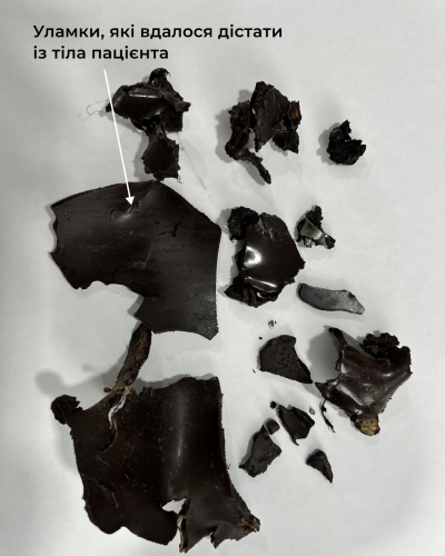 Уламки, які витягнули з Олександра