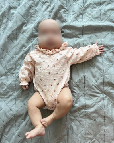 У Львові лікарі врятували немовля з двома рідкісними генетичними хворобами – 01